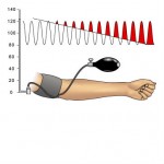 blood pressure calibration