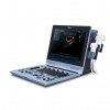 DUS 60 Ultrasound Scanner